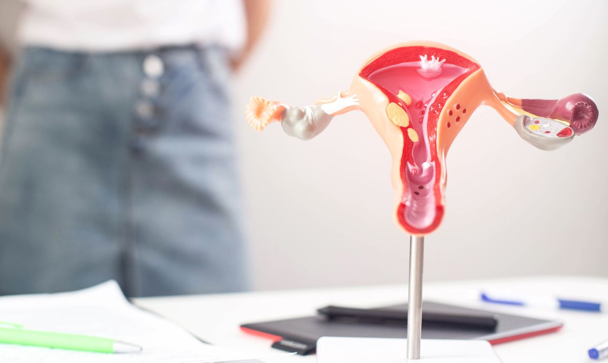 El farmacéutico, clave en la detección temprana del síndrome de ovario poliquístico