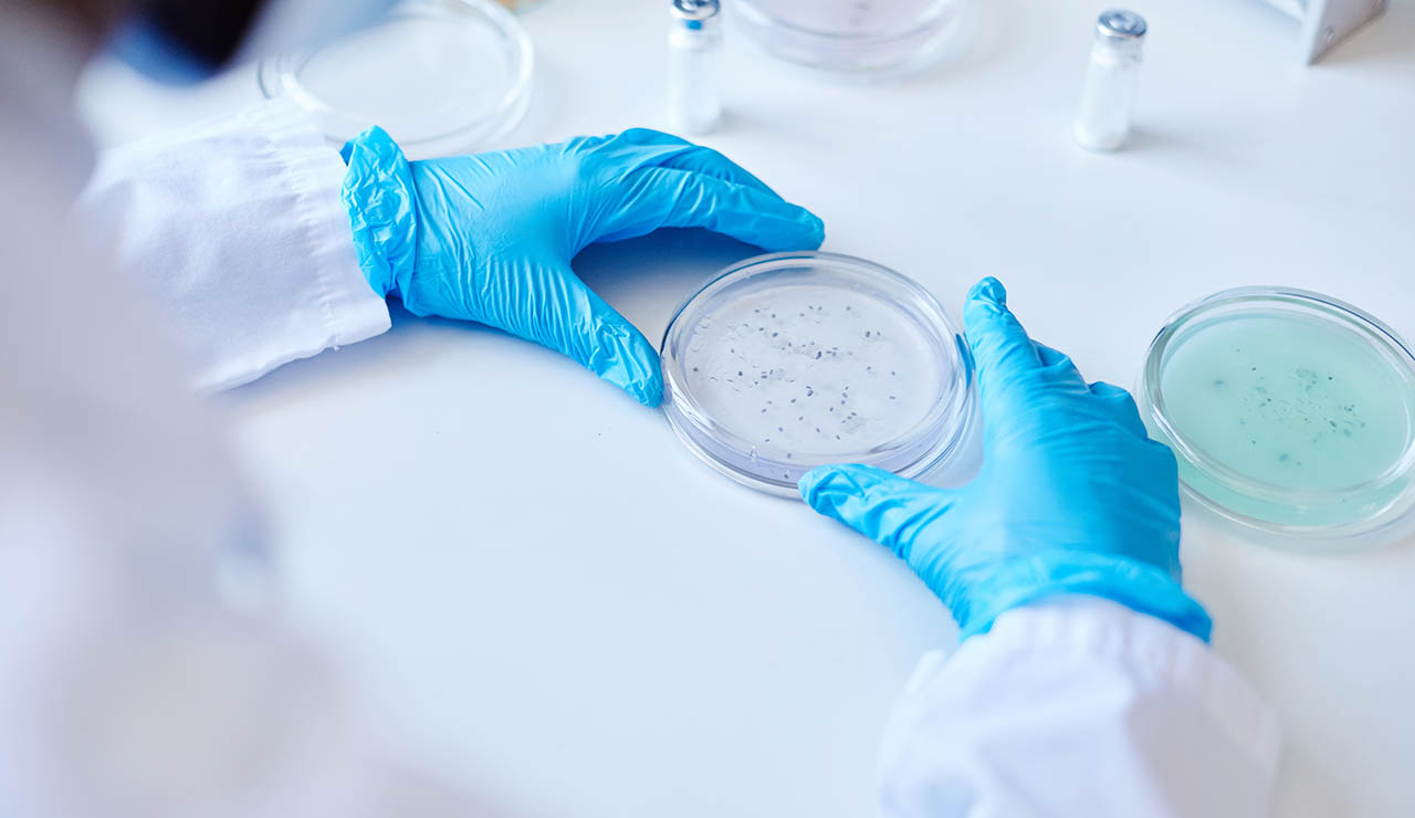 Placa con bacterias