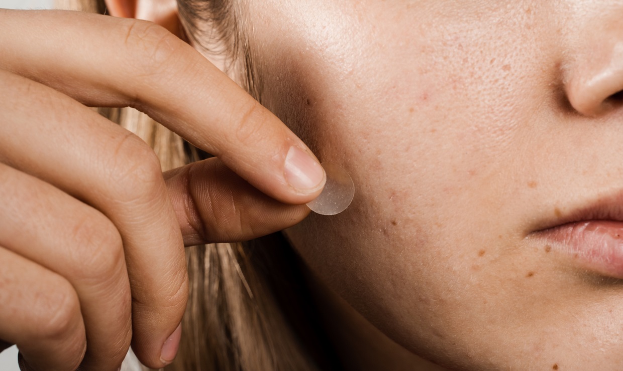 Parches para el acné, la nueva tendencia de la Generación Z