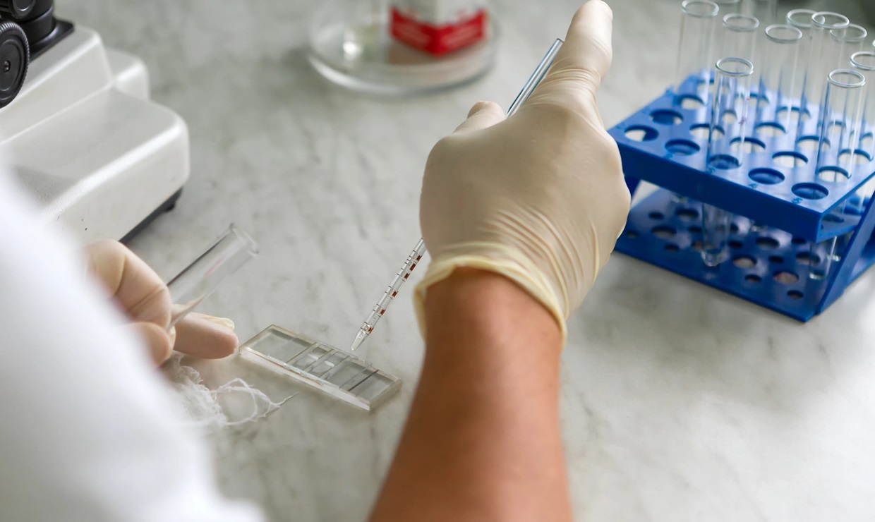 El ARN y la IA logran un 92% de precisión en la detección temprana de cinco cánceres