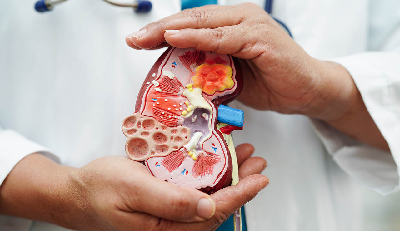 Imagen de una maqueta de un riñón