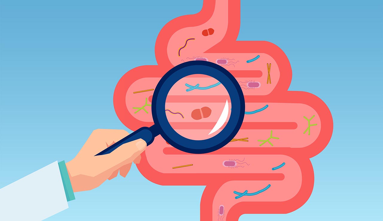Microbiota intestinal