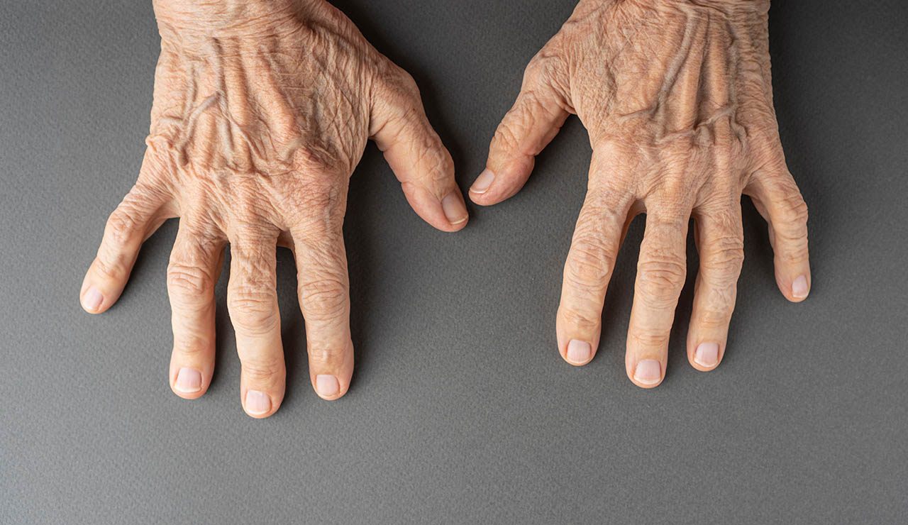 manos envejecidas