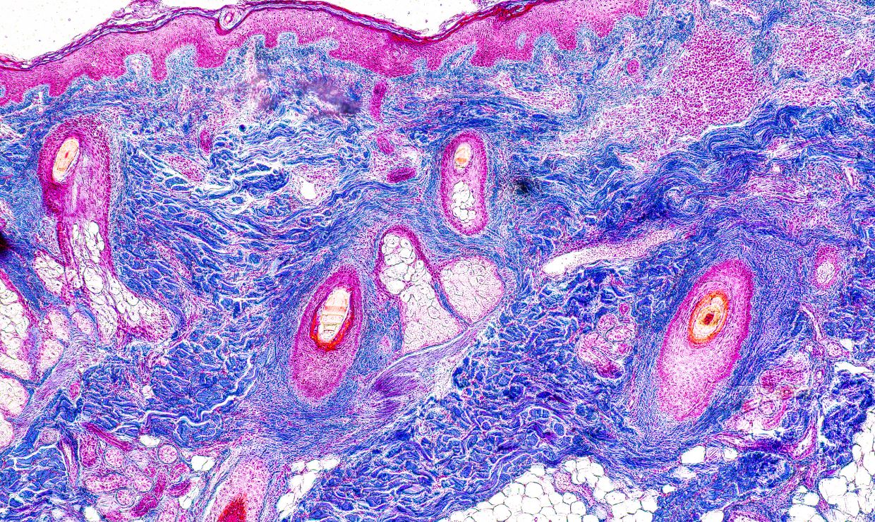 Estudios revelan el potencial de la rapamicina para retrasar el envejecimiento celular