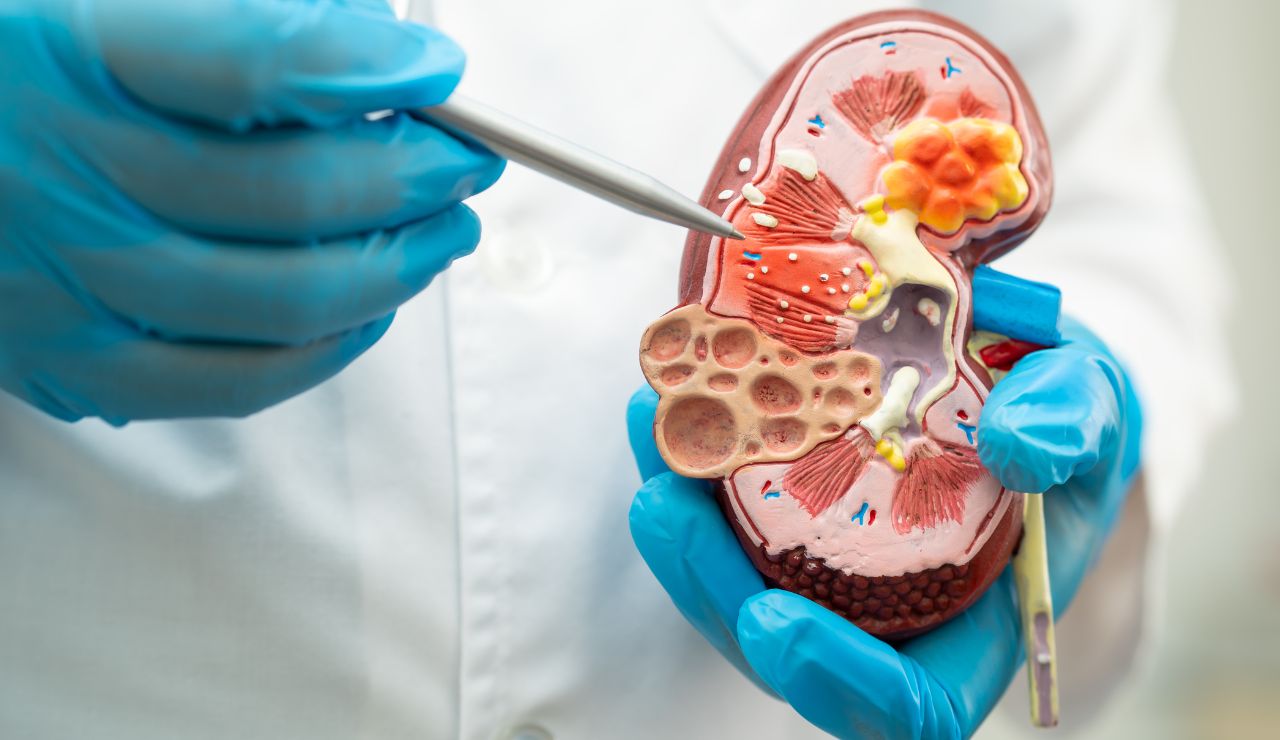 Terapias de nanopartículas para mejorar las lesiones renales