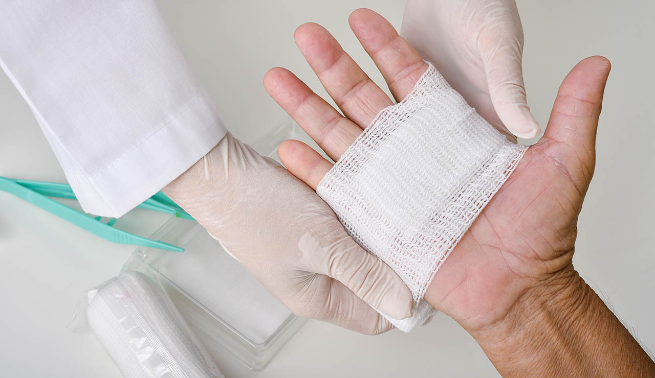 persona con herida en la mano atendida por un farmacéutico