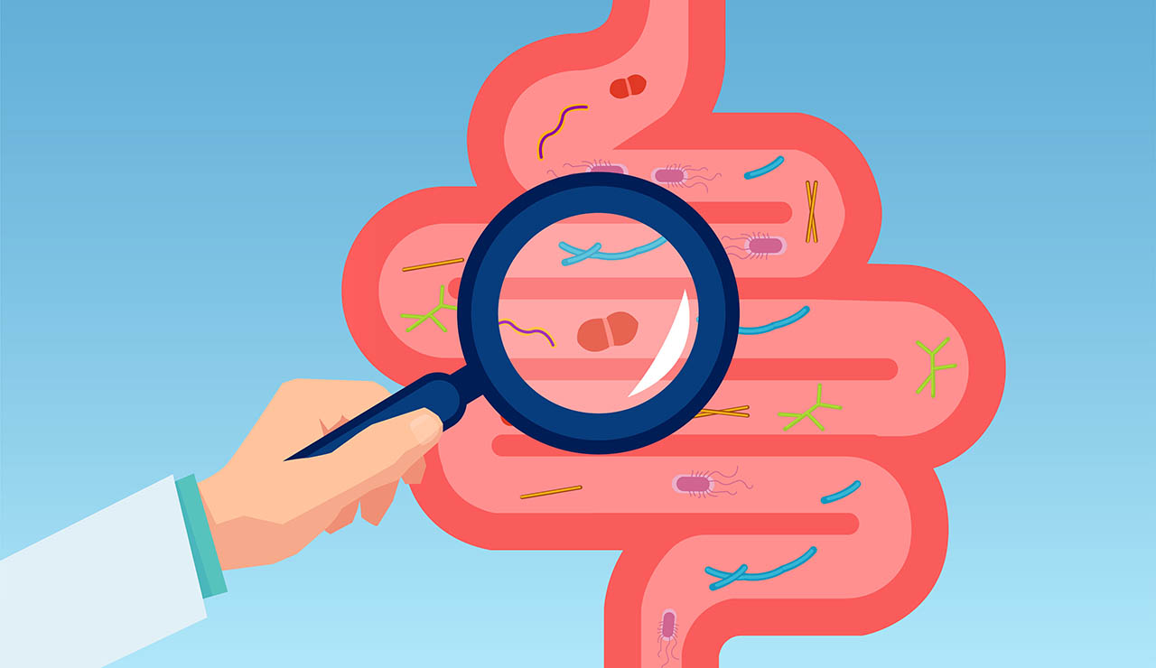 Intestino y microbiota intestinal