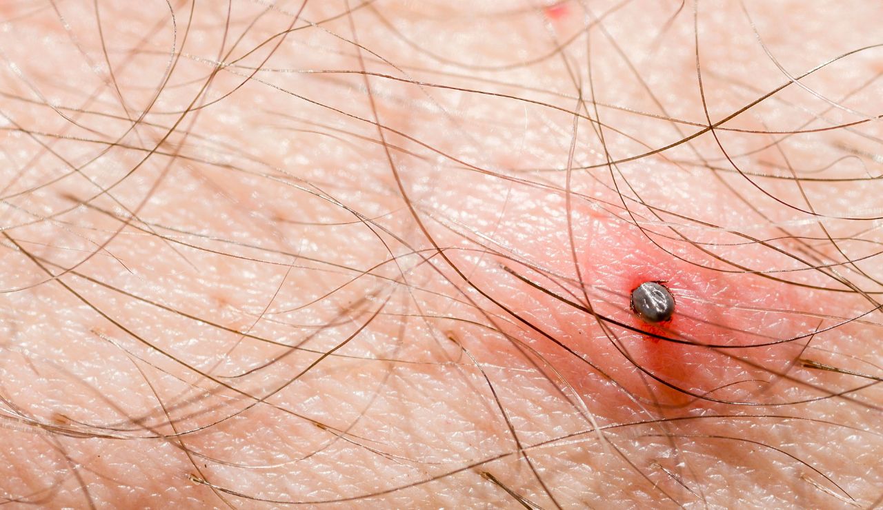 Verano y garrapatas: consejos para evitar complicaciones