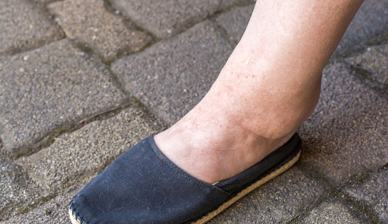 Abordaje de la retención de líquidos desde la farmacia