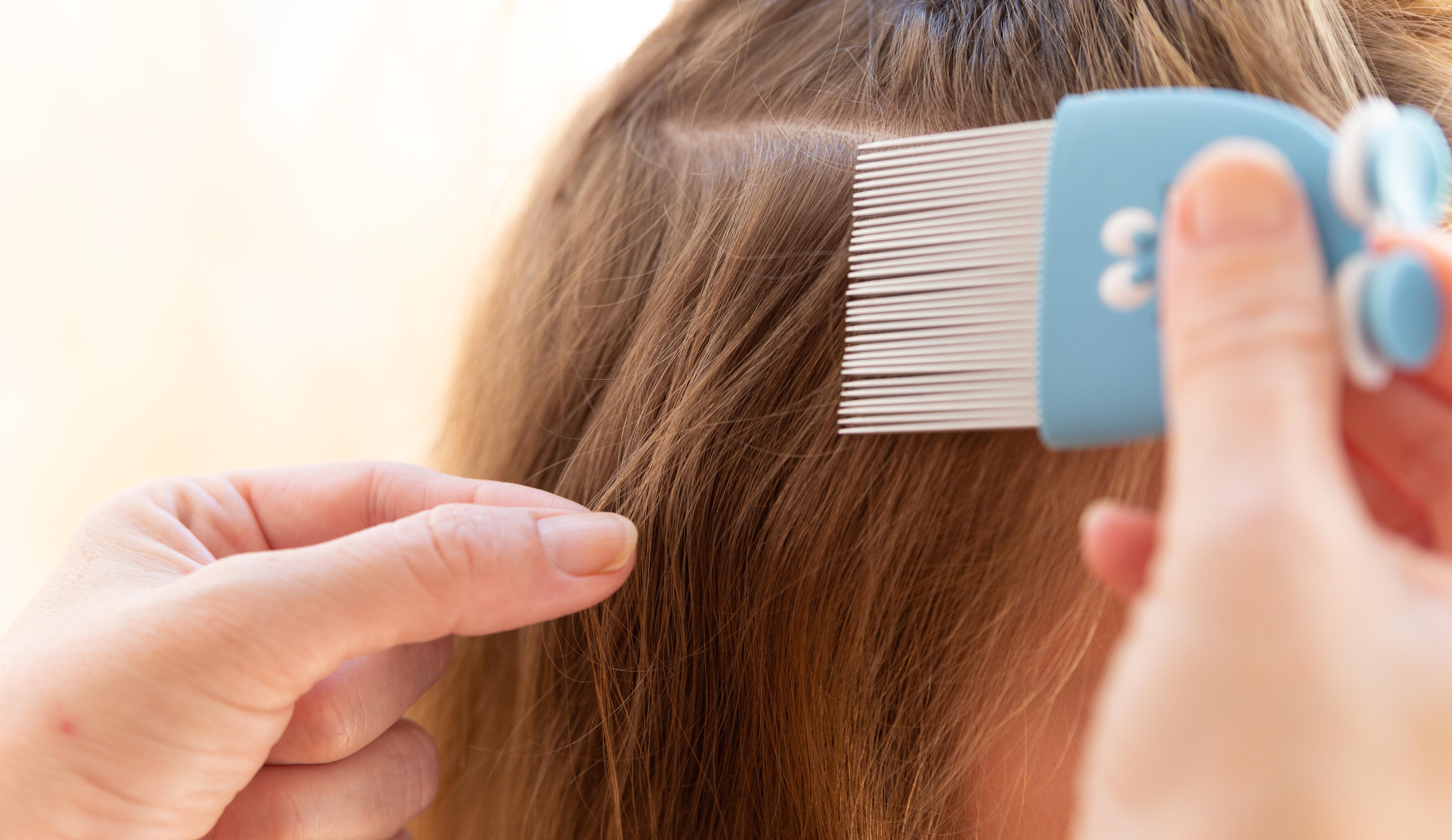 Persona quitando piojos