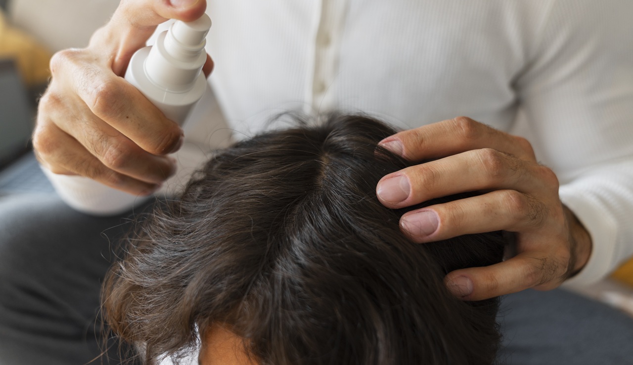 Vuelta al cole y vuelta de los piojos: ¿qué pasa si persisten demasiado tiempo?