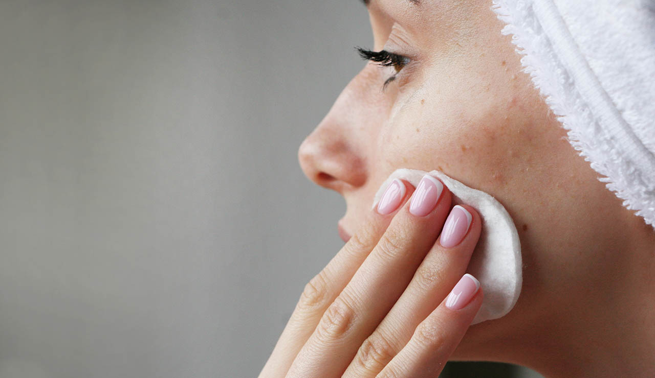 Mujer con acné