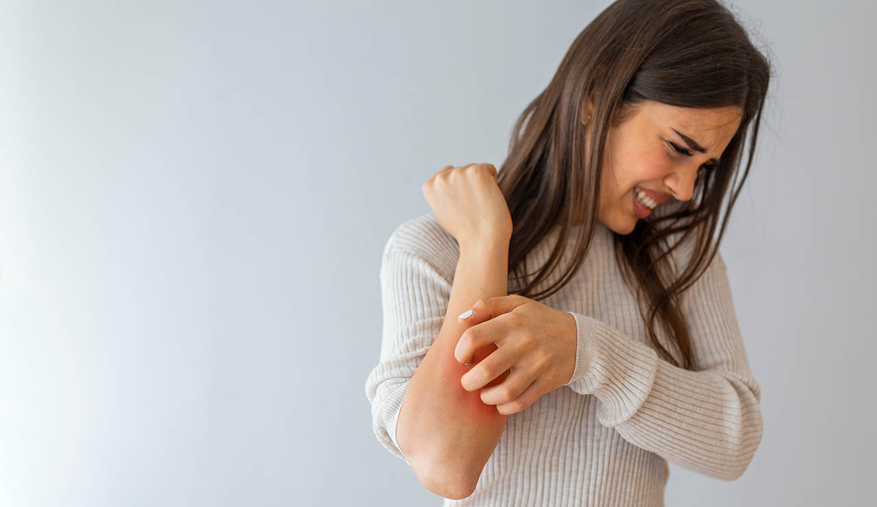 Mujer con dermatitis causada por estrés
