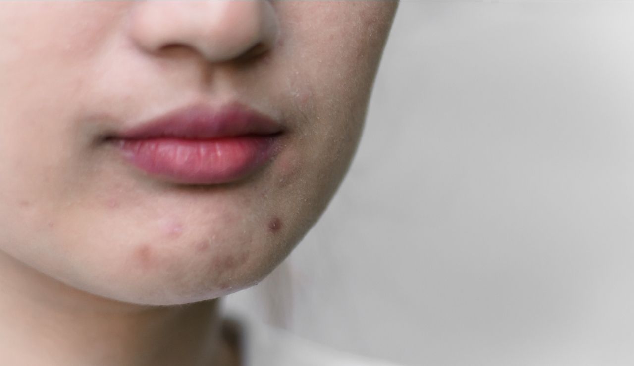 ¿Por qué mi piel rechaza algunos cosméticos?