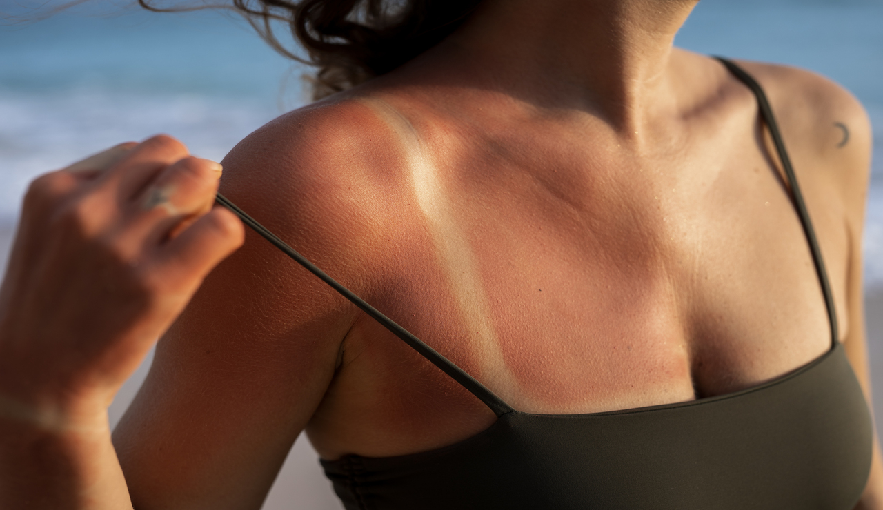 indice UV bronceado