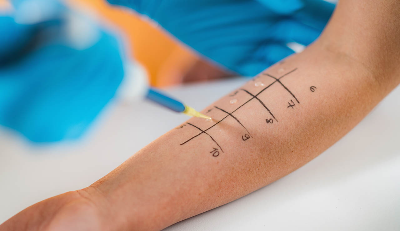Prick test