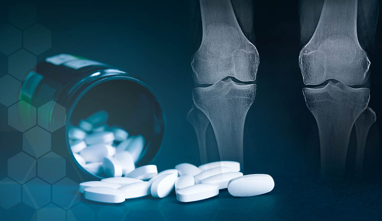 pastillas de glucosamina