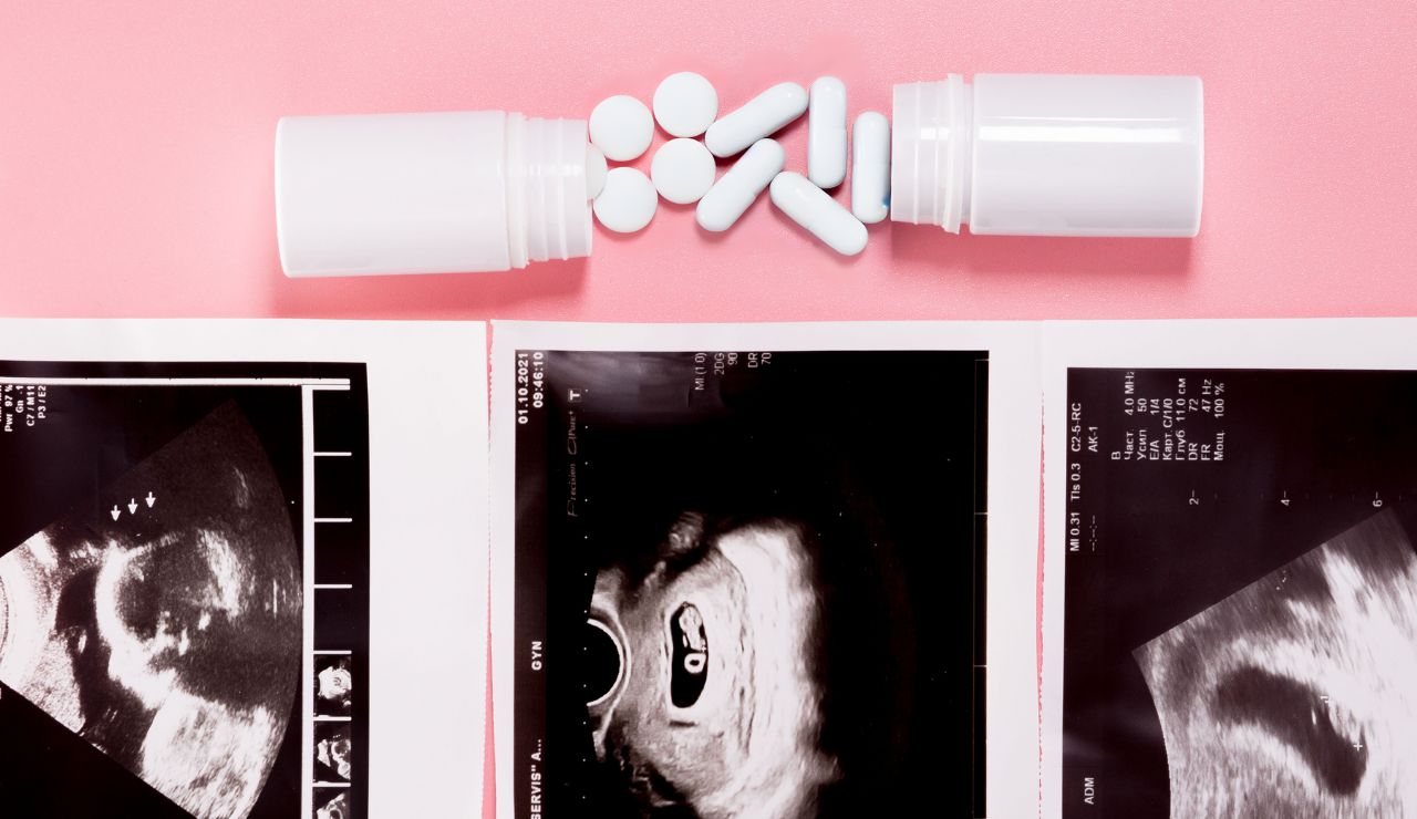 Tomar paracetamol durante el embarazo podría causar déficit de atención 
