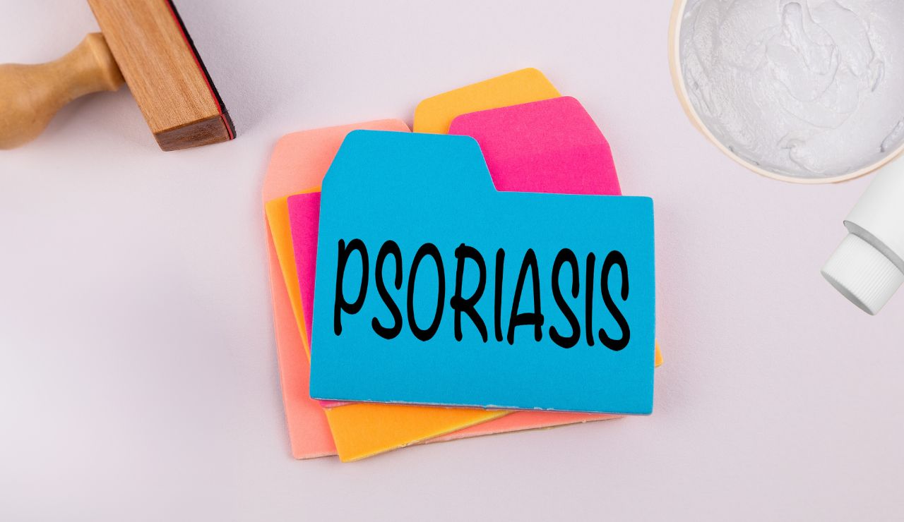 Cómo tratar la psoriasis con la llegada del frío