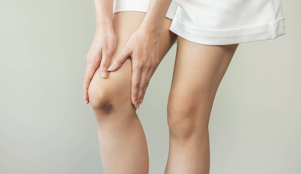 Hematoma en la rodilla