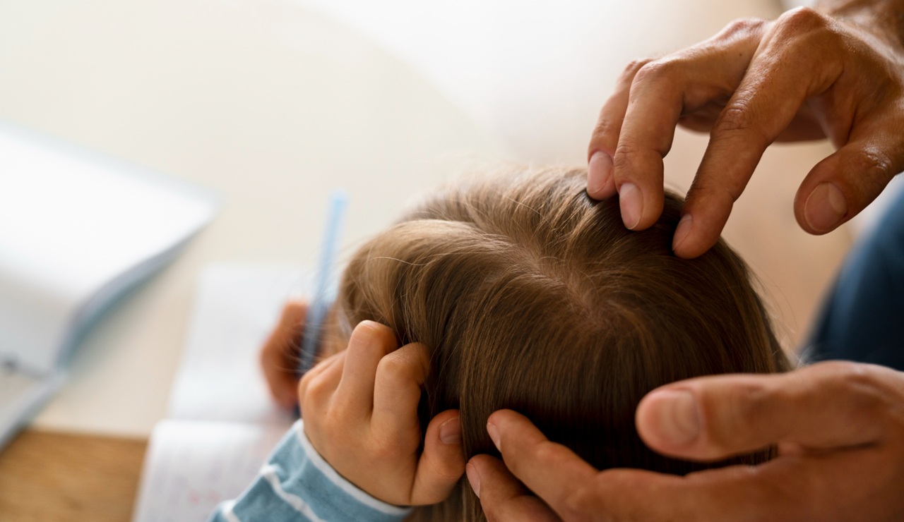 Piojos y vuelta al cole: los mitos que conviene desterrar y por qué los remedios naturales no bastan