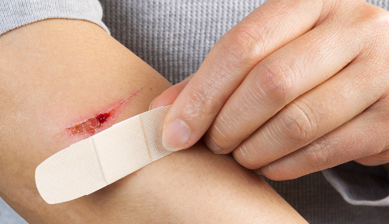 ¿Cómo curar correctamente una herida? Tips para guiar al paciente desde la farmacia