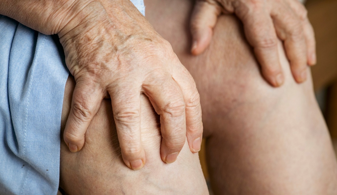 Ejercicio, niveles estables de vitaminas y calcio y evitar tóxicos: el autocuidado, clave frente a la osteoporosis